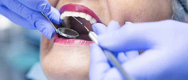 Best Dental Abscess Treatment in Solon, OH